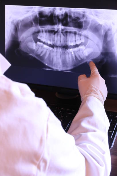 Best Broken or Chipped Tooth Repair in Butte, AK